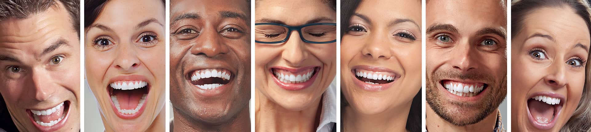 Teeth Whitening London Before and After Results