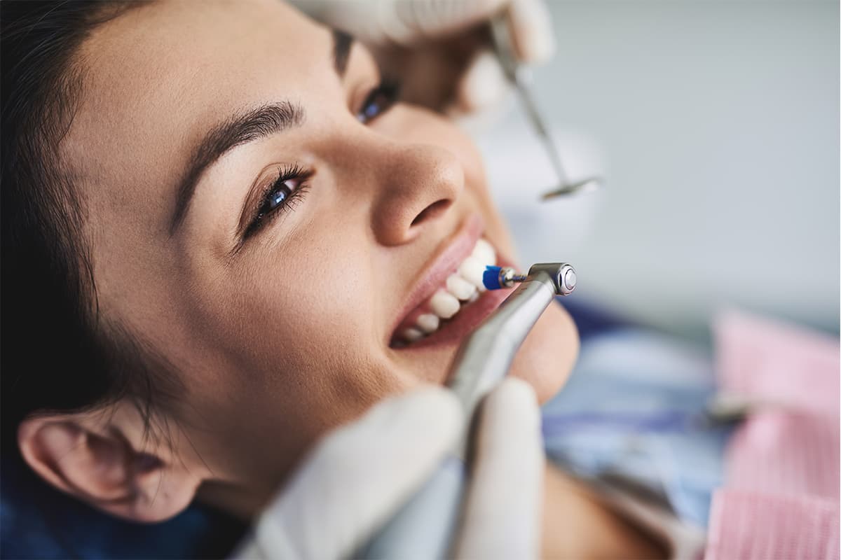 How Long Does Teeth Whitening Last? Longevity & Maintenance Tips