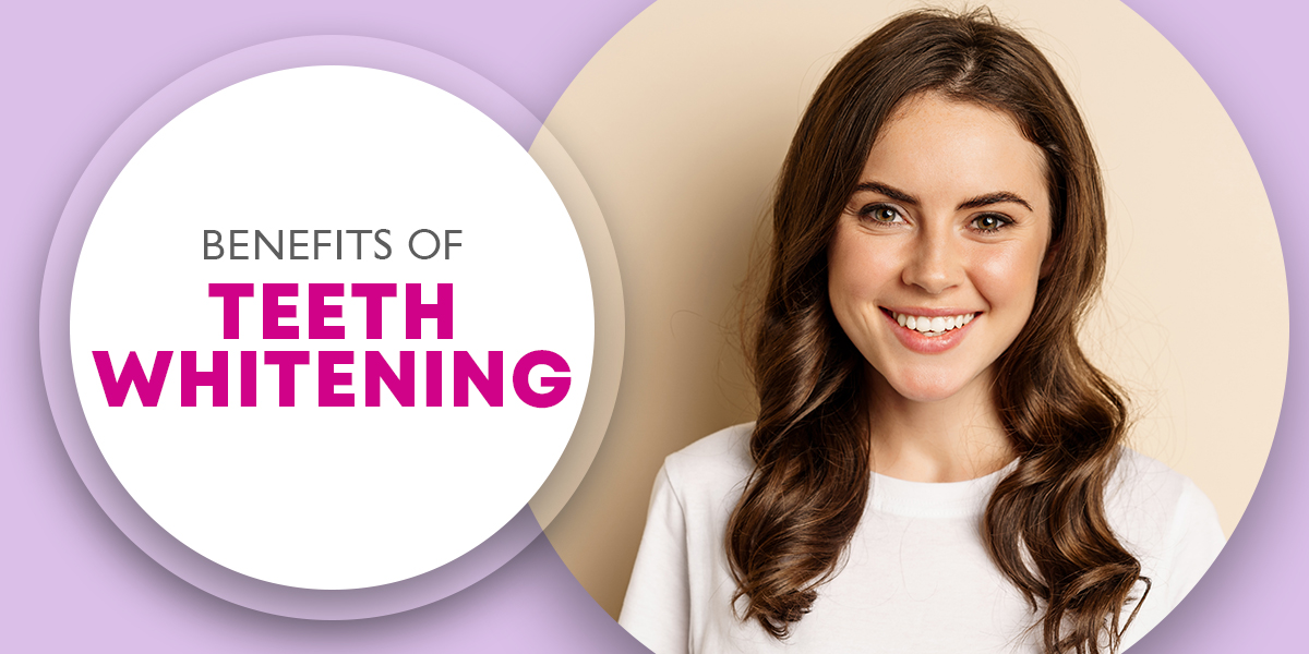 Benefits of Teeth Whitening