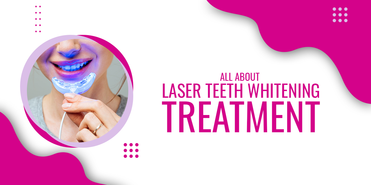 All about Laser Teeth Whitening Treatment