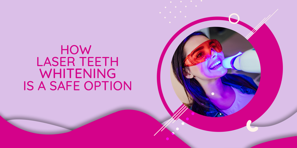 How Laser Teeth Whitening is a Safe Option?