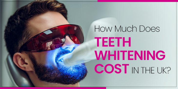 How Much Does Teeth Whitening Cost in the UK?